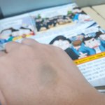 손등에 이거 <b>핏줄</b> 터진건가..?