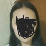 나 옆광대 <b>심해</b>??