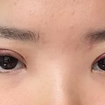 [조언부탁해] 쌍수 <b>매몰</b> 이틀됐는데 좀 봐줘!