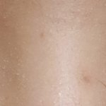 [조언부탁해] 쌍수 앞트임 고민