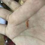 [개깊은빡침] 대구 칠곡 엽기떡볶이에서 <b>손톱</b>나온후기