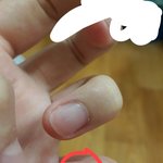 [댓글부탁해] 아니 모기새1뀌는 왜 이상한데만 무냐?