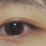 [댓글부탁해] 드뎌 쌍꺼풀 생겻다 ㅅㅂ ㅠㅠ