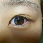 [조언부탁해] 이런 눈은 성형밖에 답 <b>없어</b>?ㅜㅜ