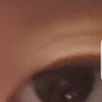 [댓글부탁해] @@@@쌍수 <b>전후</b> 어때@@@@????