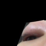 내 눈왜이러지 <b>다래</b>낀가(약혐)