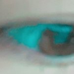 <b>내</b> <b>눈</b> 쌍꺼풀 !