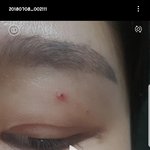 [꼭조언부탁] 진짜 조언부탁해 얼굴에 상처ㅜㅜ