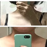 나 승모근 있는편이야.???