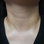 [조언부탁해] 목주름때매 죽고싶다..