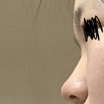 진짜 나보다 <b>코</b>낮은사람있어? (<b>사진</b> ㅇ)