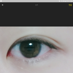 [조언부탁해] 나 쌍수 <b>재수술</b>할까,,?