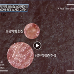 사막지역 스킨<b>케어</b> 피부 확대 영상.avi