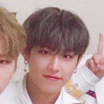 [박우진] 오늘자ㅜ 도톨이ㅜㅜㅜㅜㅜㅜㅜㅜ똥그래 ㅠㅠㅠ