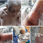 [드루와] 할머니가 학대를 당하셨어 도와줘