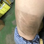 이정도 폭력으로도 노동부 신고가능 한가요?