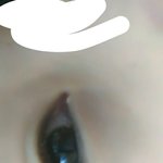 하씌1발 <b>쌍꺼풀</b> <b>수술</b>하고시ㅠ가