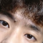 남자인데 쌍수할까?