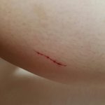 [댓글부탁해] 자해<b>티나</b>??????