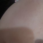 [조언부탁해] 얘들아 제발도<b>와조</b>ㅜㅡ얼굴에 난거