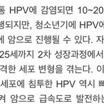 [워마드띵문] [페미니즘] 20대 초반에 <b>hpv</b>에 걸리면 위험한...