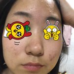 얘들아 나 피부 완전 좋아짐(사진 ㅇ)
