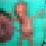 이번엔 <b>태아</b>에 가위질, 천인공노할 워마드 만행[기사]