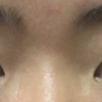 [드루와] <b>눈성형</b> 할건데 사진 봐줘