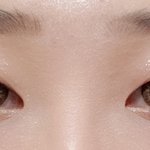 니네 <b>이</b> <b>눈</b>이면 쌍수할거냐 사진내림~