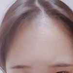 나 <b>이마</b> <b>조카</b>넓지