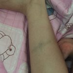 [댓글부탁해] 등굣길에 차에치였는데