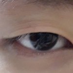 [댓글부탁해] 나 쌍수 잘될 거 같아?ㅠ (쌍액사진)