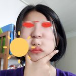 [댓글부탁해] 이런 코 수술 어떻게 해?ㅜㅜ