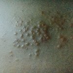 허벅지에 소금 <b>알갱이</b>같은게 수십개 돋아나요