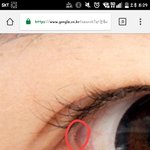 [댓글부탁해] <b>눈</b> <b>이</b> 부분 땡기거나 비비면