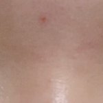 [댓글조언꼭] <b>쌍수</b> 붓기랑 라인좀 봐줘 ㅠㅠㅠㅠㅠ