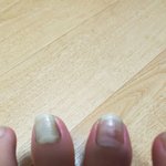 [댓글부탁해] 내 <b>발톱</b>색 왜이럼?