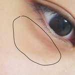 [댓글부탁해] <b>눈밑</b>에 이거 도대체뭐임?