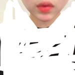 [드루와] 1시간전에 턱끝<b>필러</b> <b>맞음</b> 질문받음