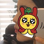 [드루와] <b>무턱</b>필러 맞았는데 ㄹㅇ존좋