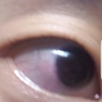 [댓글부탁해] 나 <b>충혈</b> 심하냐.....