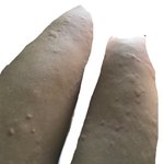 두드러기 조카 많이남 왜<b>이래</b> ( 혐 주의 )