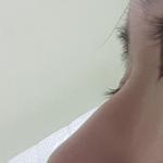 [조언부탁] [조언 부탁해 ] 옆광대 축소 수술 <b>or</b> 코수술 (사진있음)