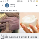 [드루와] 아토피 있는 애들아ㅠㅠㅠㅠ