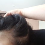 <b>탈모인</b>것같지..