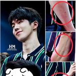 [댓글부탁해] 해외 팬미팅에서 팔에 난 상처 만신창이가 된 <b>남주혁</b>
