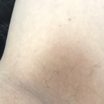 [댓글부탁해] 너네도 겨드랑이 <b>이정도</b>로 까매???