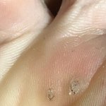 [사진혐오] 얘들아 이거 발바닥<b>무좀</b>이야..?