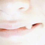 <b>덧니</b>로 이거 되는 애들 있어?