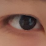 내 쌍꺼풀라인 <b>오때</b>